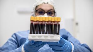 koronavirus covid-19 test