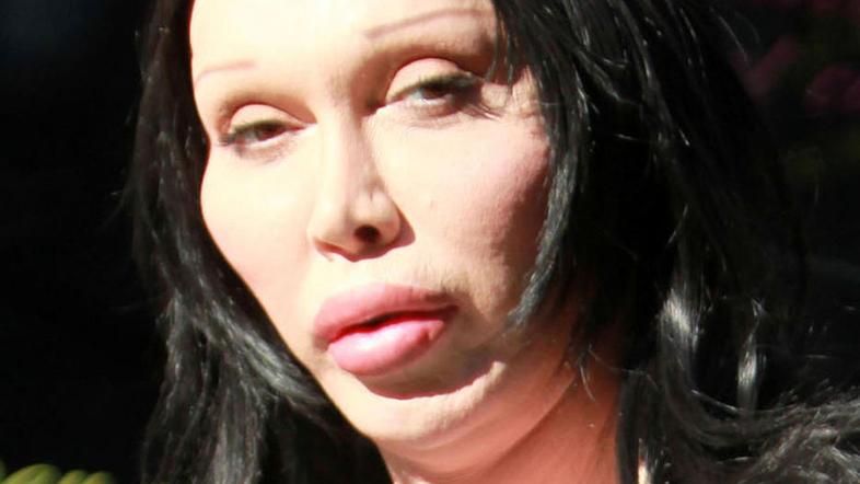 Pete Burns