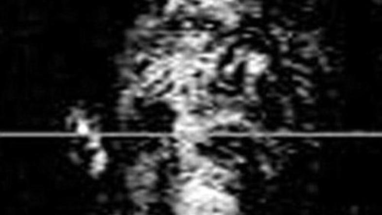 Fotografija ene izmed napadalk. (Foto: Daily Mail)