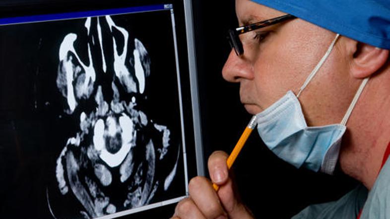 V raziskavi, ki so jo opravili na inštitutu Max Planck v Berlinu, je sodelovalo 