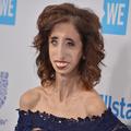 Lizzie Velasquez