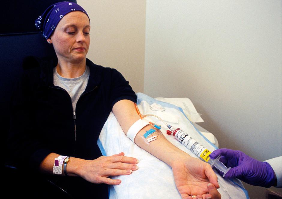 Kemoterapija | Avtor: Profimedia