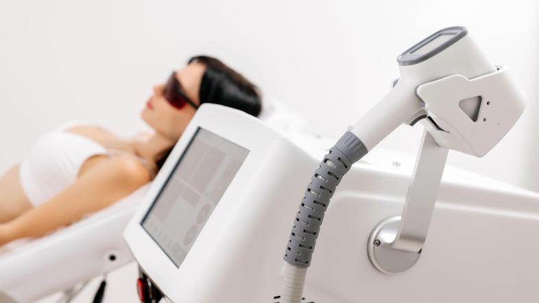 Lasersko odstranjevanje dlak