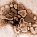 Virus influence H1N1