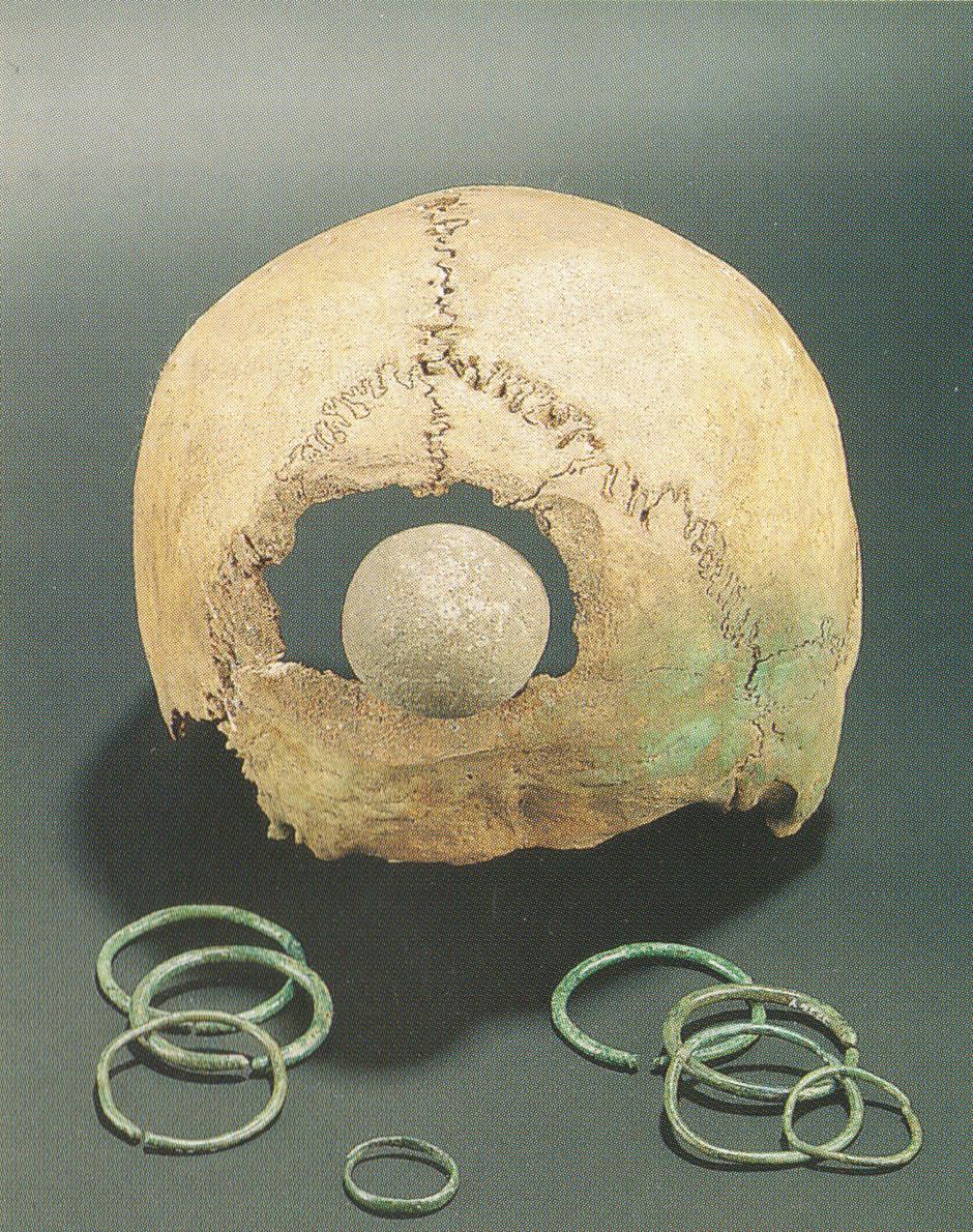 Lobanja, Gorenjski muzej | Avtor: arhiv Gorenjski muzej Kranj