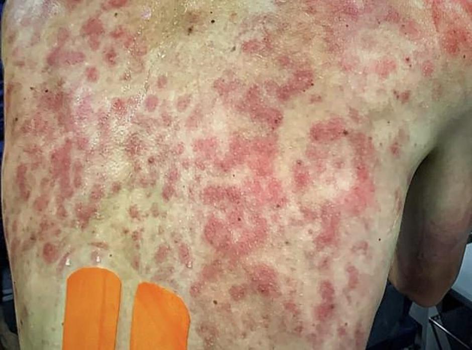 Tim Declercq toča Dauphine | Avtor: Reševalni pas/Twitter