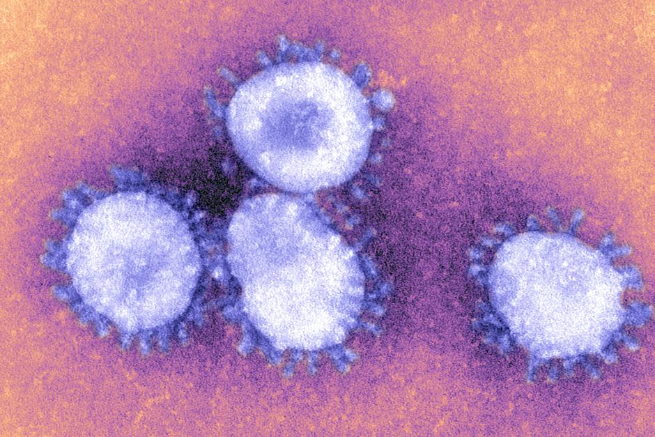 Koronavirus covid-19 | Avtor: Profimedia