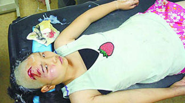 Cheng Cheng se dogodka ne spominja.