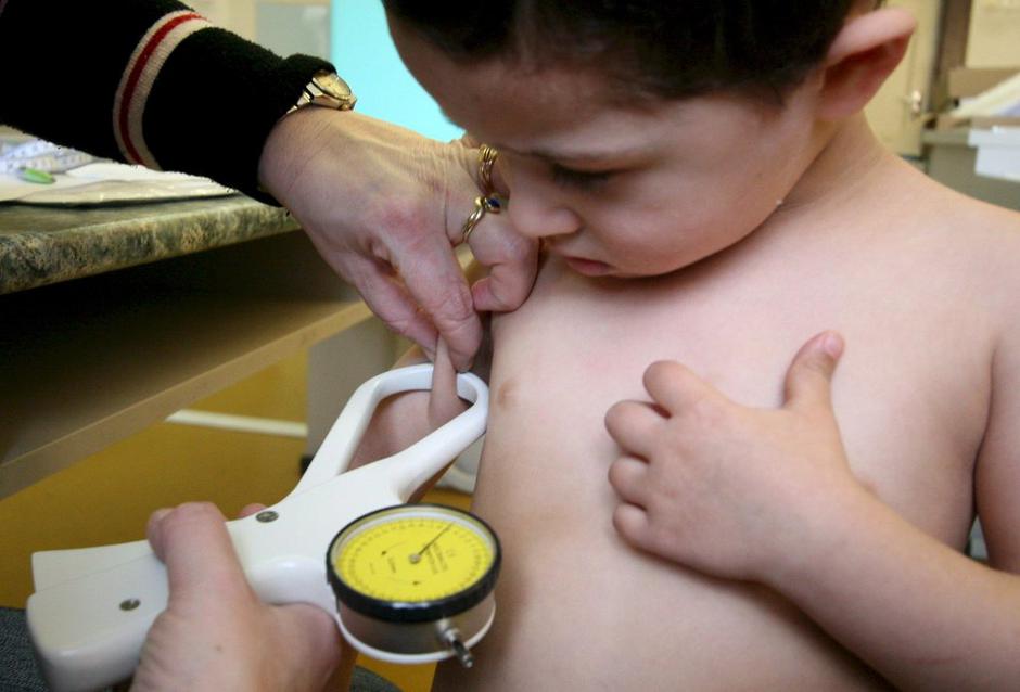 Debelost | Avtor: EPA