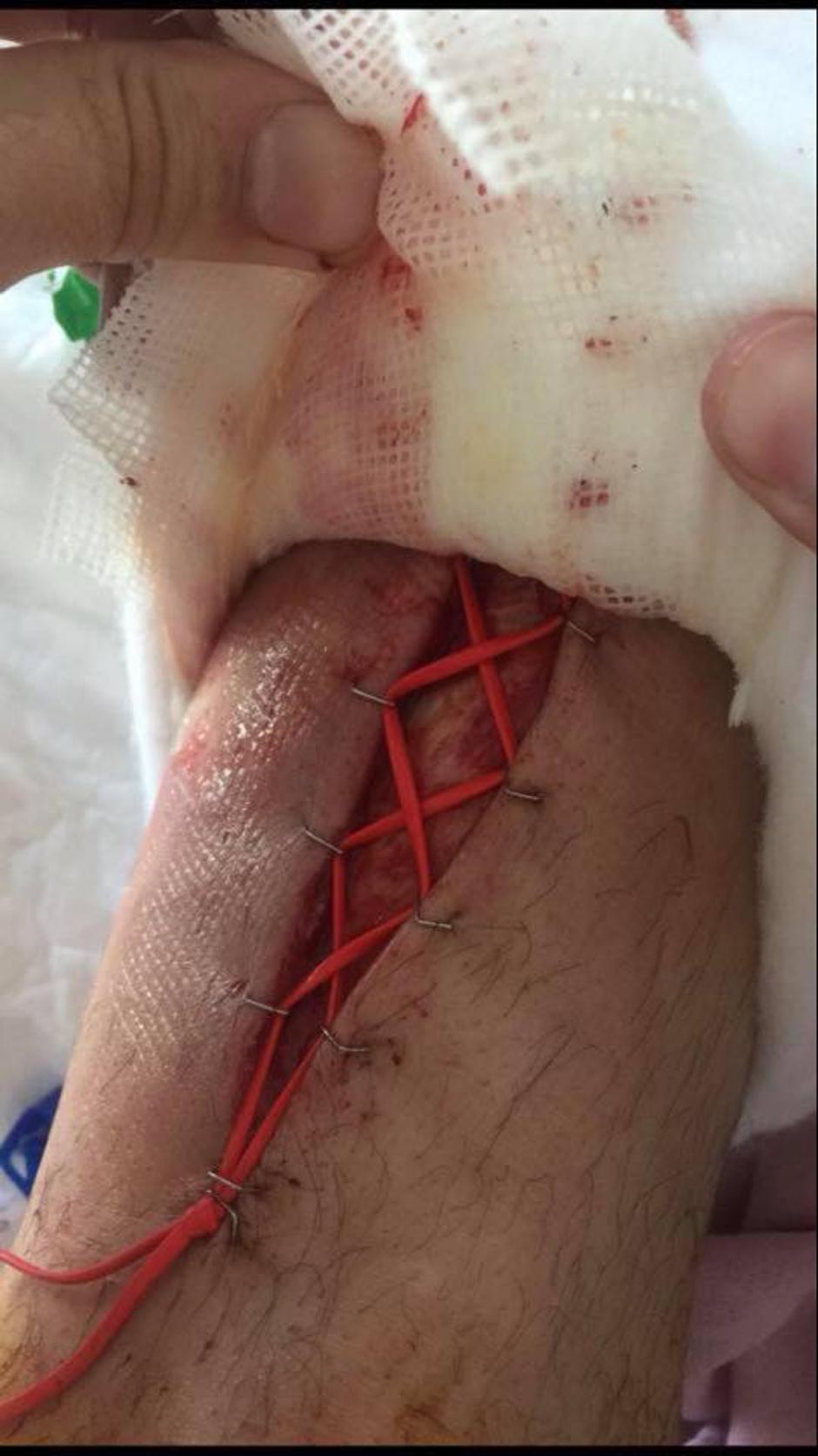 Poškodbe zaradi orjaškega dežena | Avtor: 