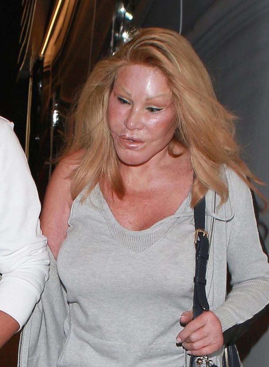 Jocelyn Wildenstein | Avtor: Profimedias