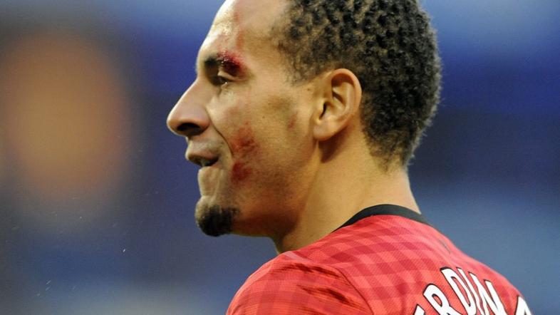 rio ferdinand kovanec incident