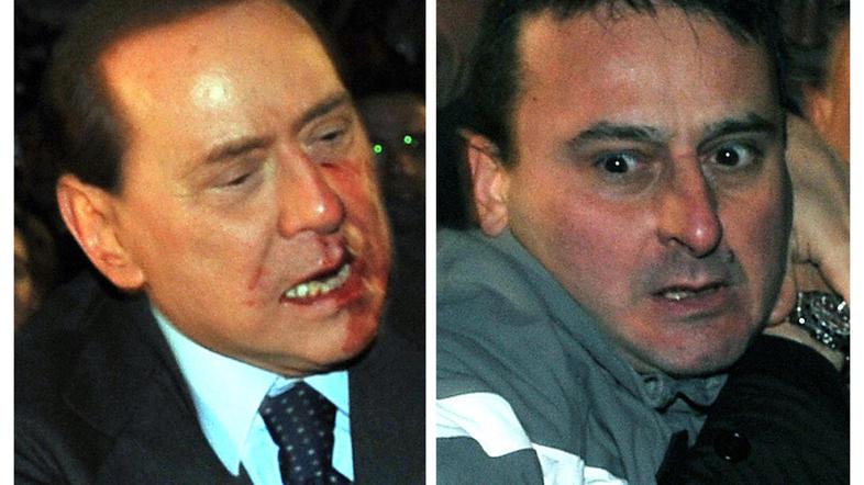 Napadalec se je Berlusconiju že opravičil. (Foto: Reuters)