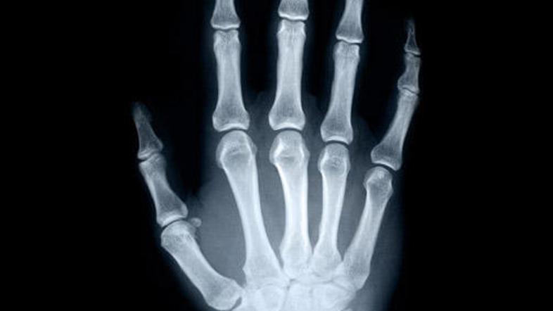 Ko se bodo rešitve vojske začele uporabljati v vseh bolnišnicah, bodo hude poško