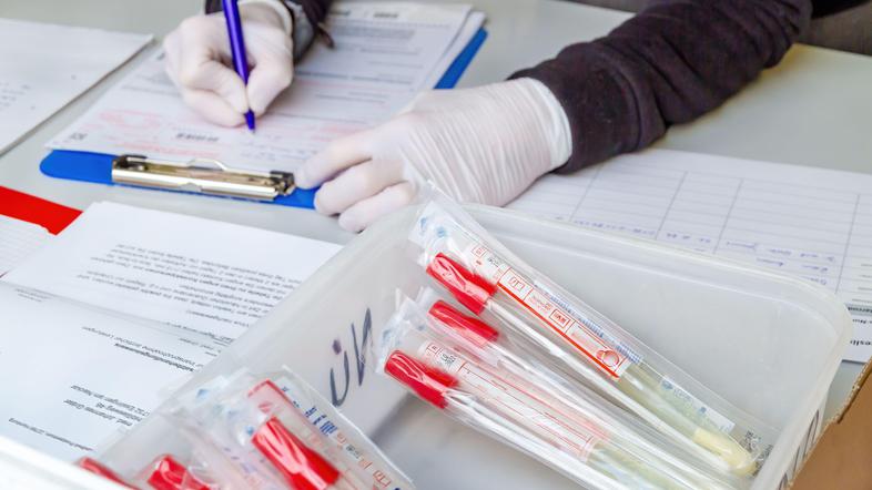 Testiranje na covid-19