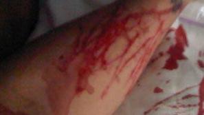 Fotografija, ki je prestrašila oboževalce.