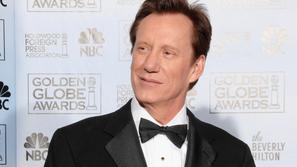 James Woods