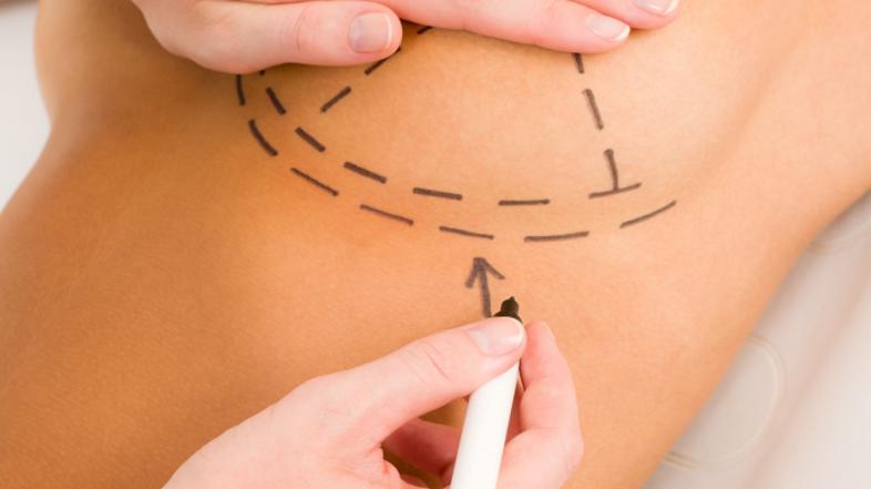 Zivljenje, operacija 17.04.2014 Shutterstoock