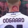 Odgaard