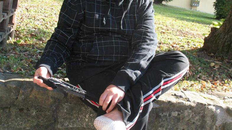 Trinajstletni Denis Čajko je bil danes že doma, z opečeno nogo in poškodbami na 