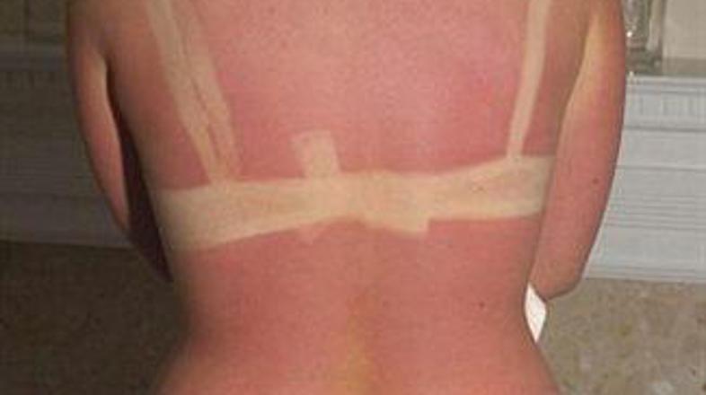 Hrbet nespametne Kirsty