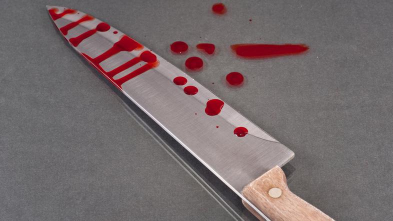 (Slika je simbolična.)