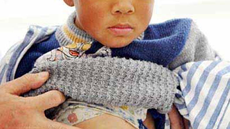 Njegovo srce se vidi od zunaj, prav tako tudi utripanje.