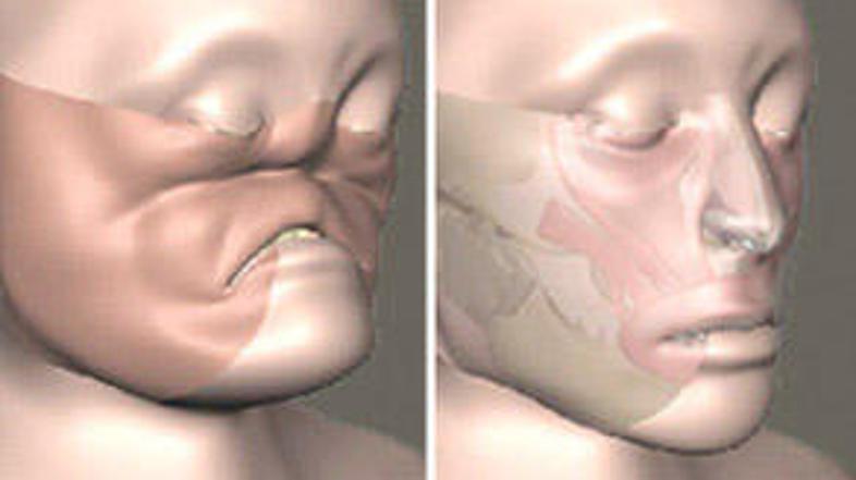 Pacientka je dobila nov obraz.