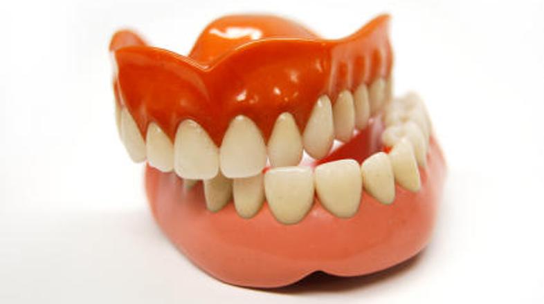 Zobna proteza je le eden od nenavadnih predmetov, ki jih gostje pozabijo v hotel