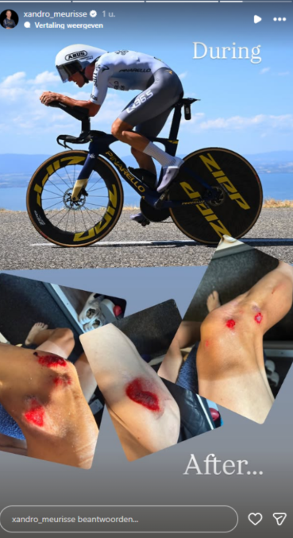 Xandro Meurisse | Avtor: Instagram