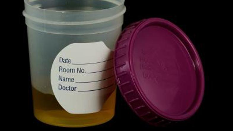 Pri okužbi je vonj seča neprijeten, zaznati je celo smrad.