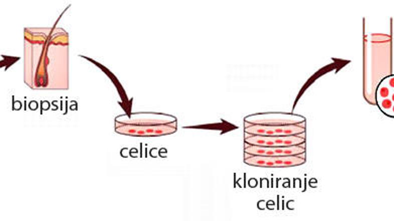 Britansko podjetje Interxytlex bo čez pet let, ko bo tehnologija nared, ponudilo
