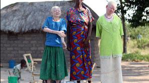 Verovanje v čarovništvo je v nekaterih delih Afrike še vedno močno prisotno.