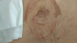 Ugriz želve na otoku Čiovo