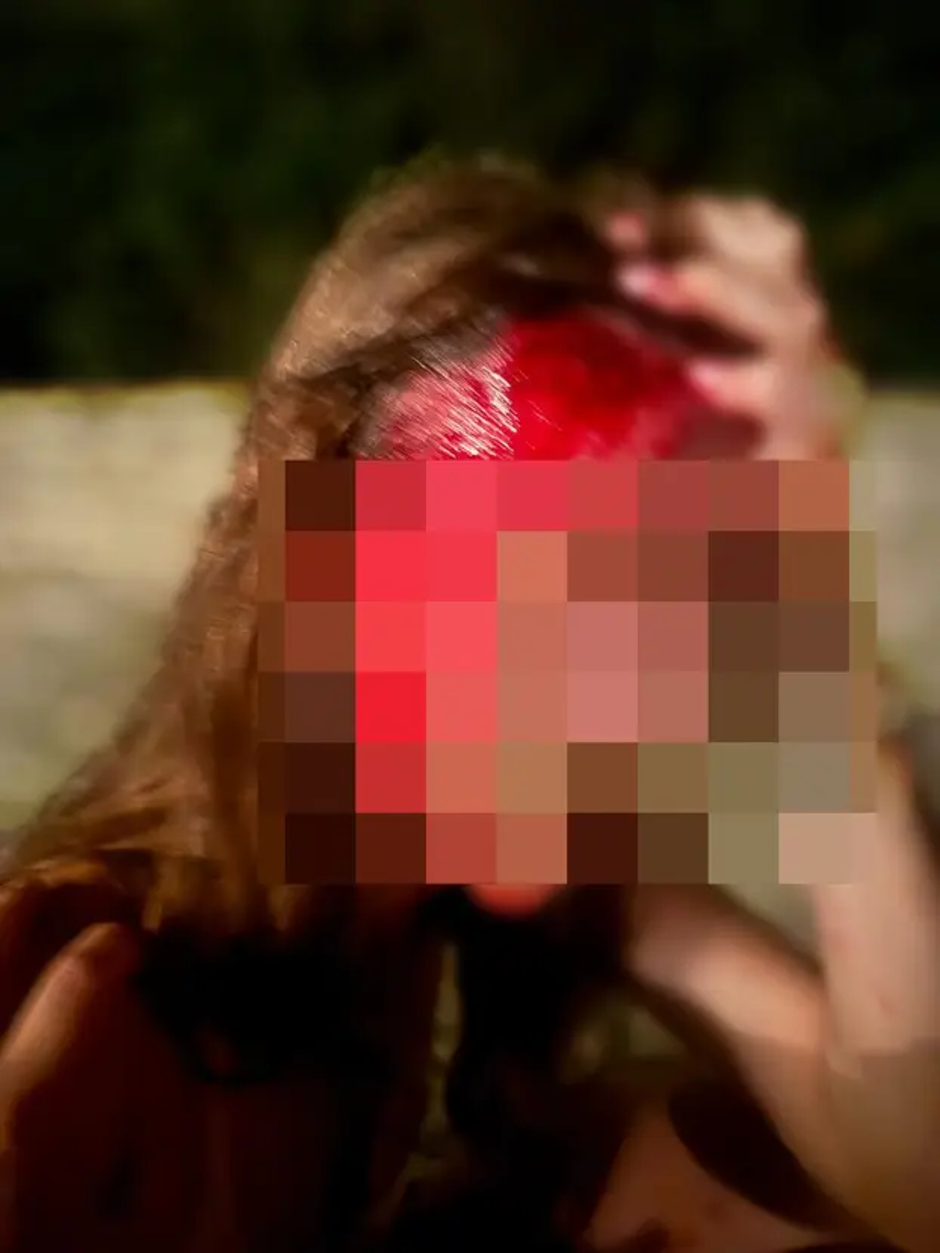 Pretep med varnostniki in Slovenci v Savudriji | Avtor: 24sata