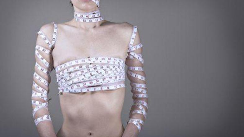 Obsedenost z osebnim videzom lahko usodno škoduje zdravju.