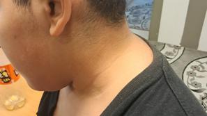 Napad na romskega otroka