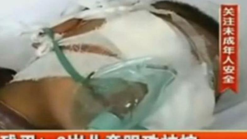 deček oči kitajska 