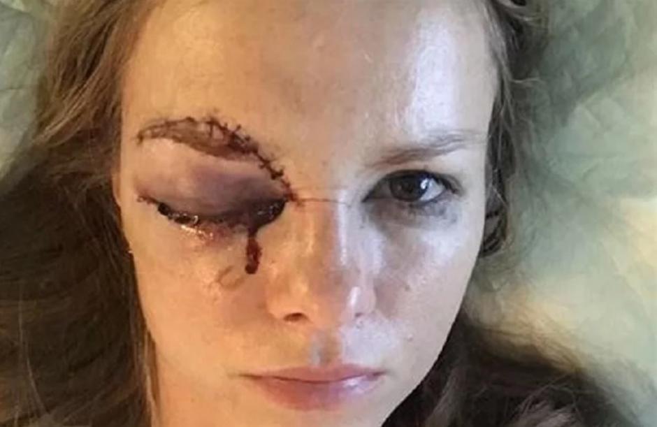 ziačikova | Avtor: Instagram