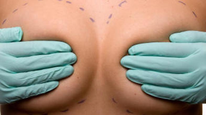 Ženske, mlajše od 18. let v Italiji ne bodo smele več k lepotnemu kirurgu. (Foto