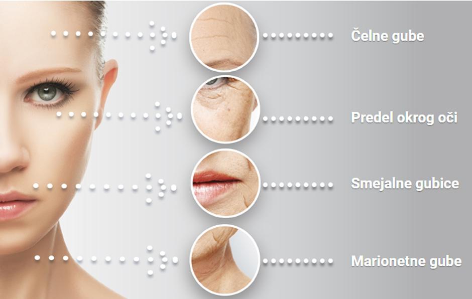 PostQuam | Avtor: PostQuam