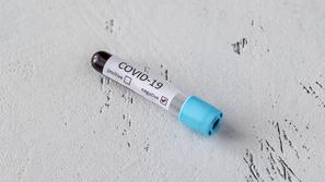 Covid-19 test vzorec korona