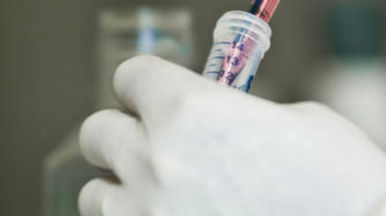 Malik meni, da matičnih celic ne bi smeli uporabljati pri pomlajevanju. (Foto: S