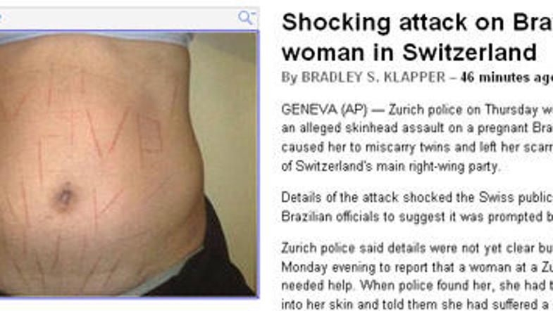 Ameriška tiskovna agencija AP je objavila šokantno fotografijo trebuha noseče Br