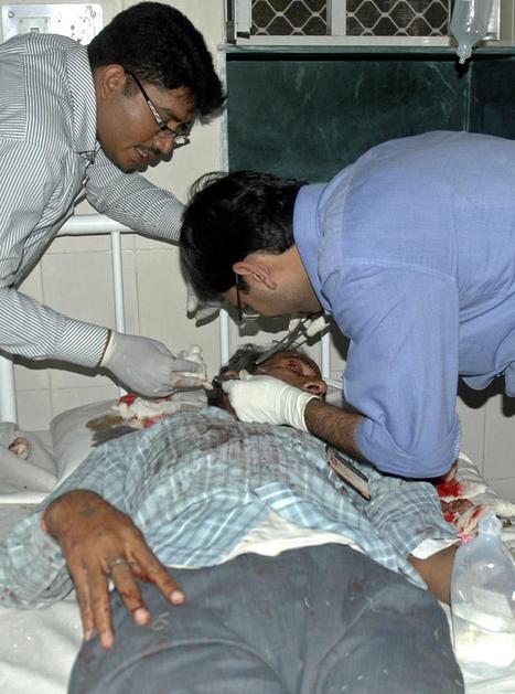 Poškodovani so utrpeli hude poškodbe, zlasti opekline. Foto: Reuters