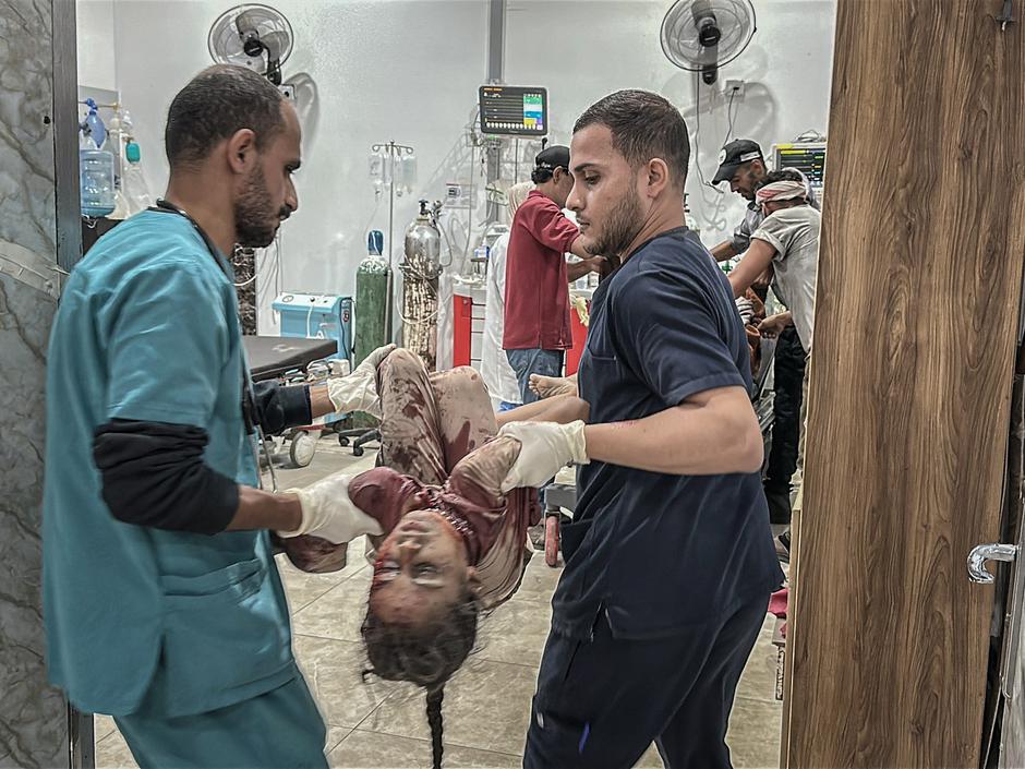 Gaza otrok bolnišnica | Avtor: Profimedia