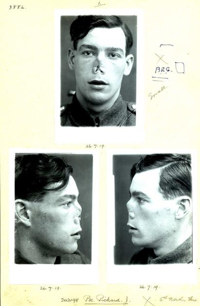 Plastične operacije