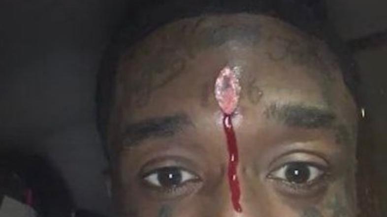 lil uzi