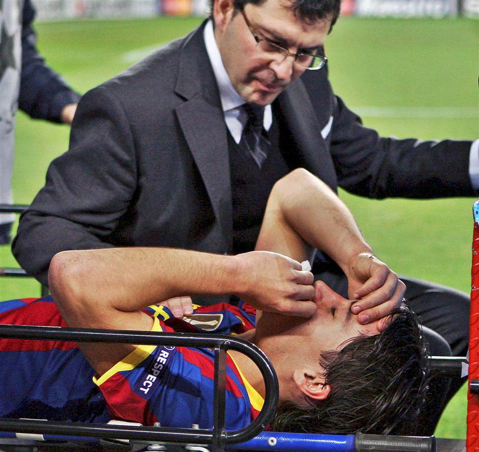 Bojan Krkic Krki%C4%87 poskodba po%C5%A1kodba nos kri | Avtor: Žurnal24 main