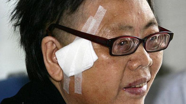 He se veseli trenutkov brez glavobola.